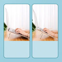 حامل قابل للطي للابتوب UGREEN فضي | Folding Stand for MacBook Laptop Silver